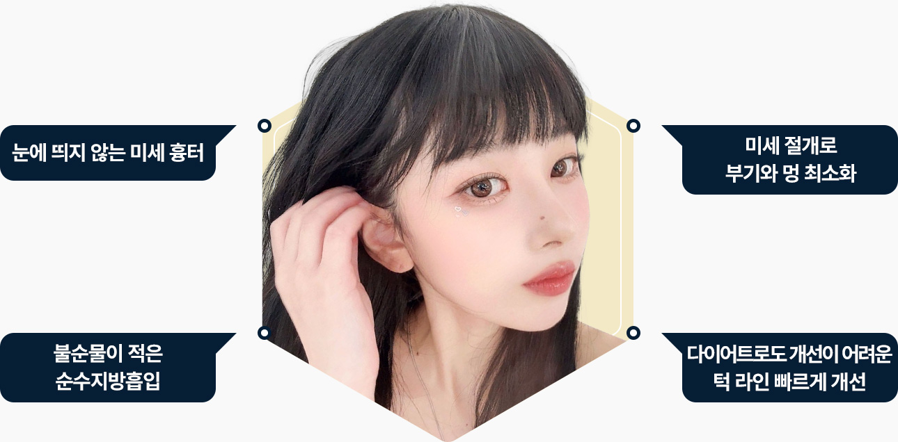 이중턱지방흡입 미세흉터 미세절개 붓기 멍 최소화 불순물이 적은 순수지방흡입 다이어트로 개선이 어려운 턱라인 개선