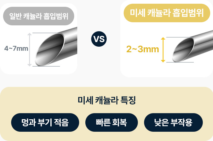 이중턱 근육묶기 일반캐뉼라 흡입범위 4mm에서 7mm 미세캐뉼라 흡입범위 2mm에서 3mm 미세캐뉼라 특징 멍 붓기 적음 빠른 회복 낮은 부작용