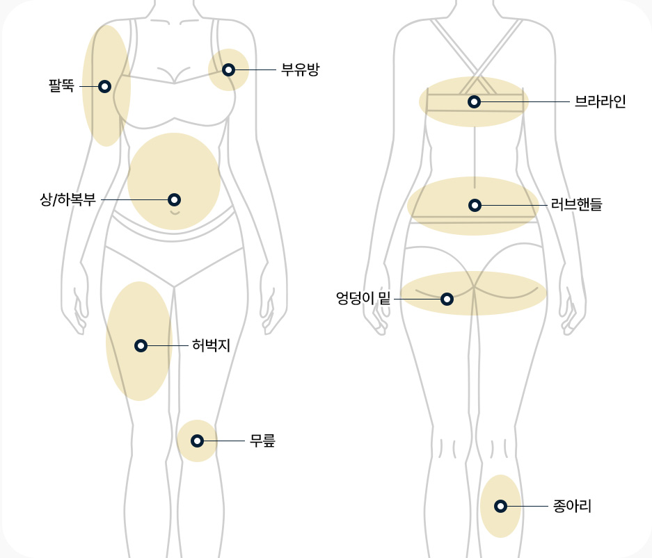 원더핏주사(바디) 지방분해주사 시술 부위 팔뚝 부유방 상하복부 허벅지 무릎 브라라인 러브핸들 엉덩이밑 종아리