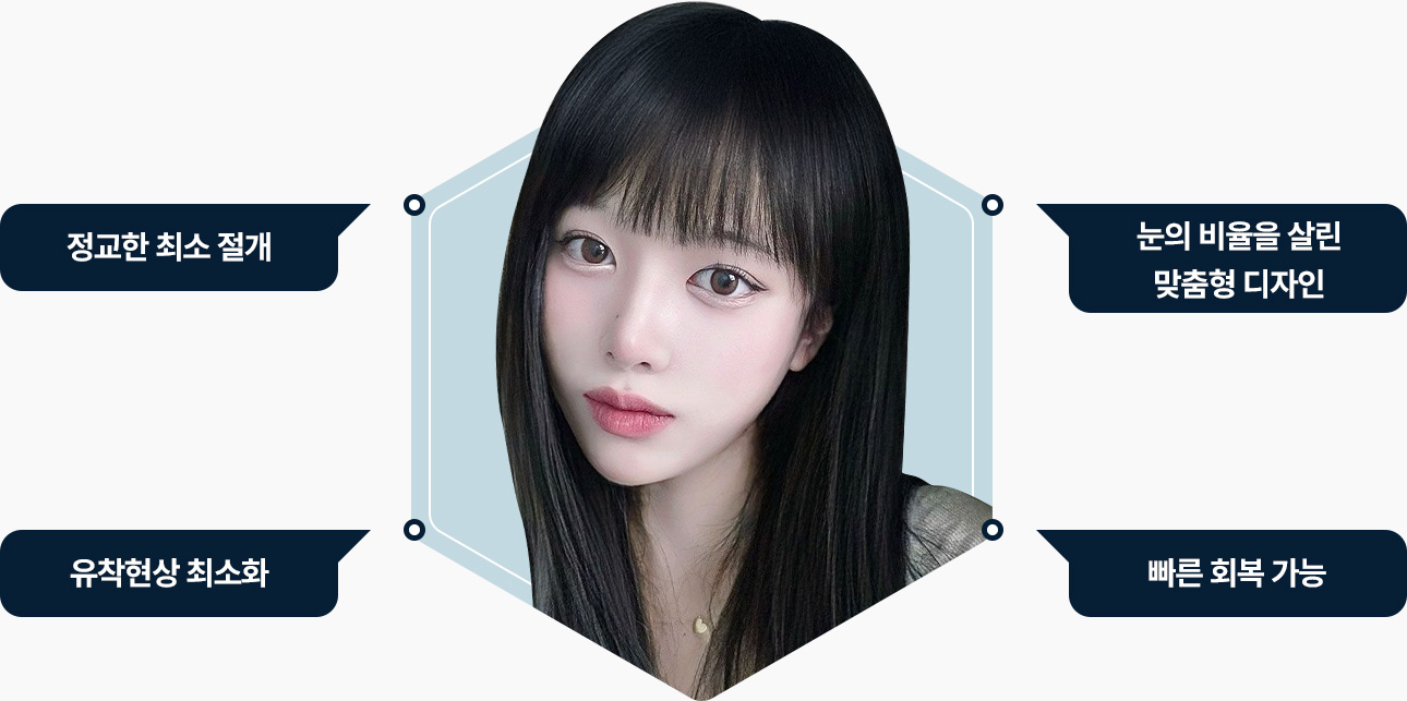 최소 절개 눈 비율 맞춤형 디자인 유착현상 최소화 빠른회복