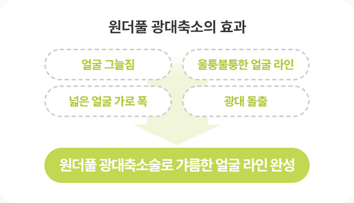 광대축소 효과 얼굴그늘짐 넓은얼굴 가로폭 울퉁불퉁 얼굴라인 광대돌출 원더풀 광대축소술 갸름한 얼굴라인 완성