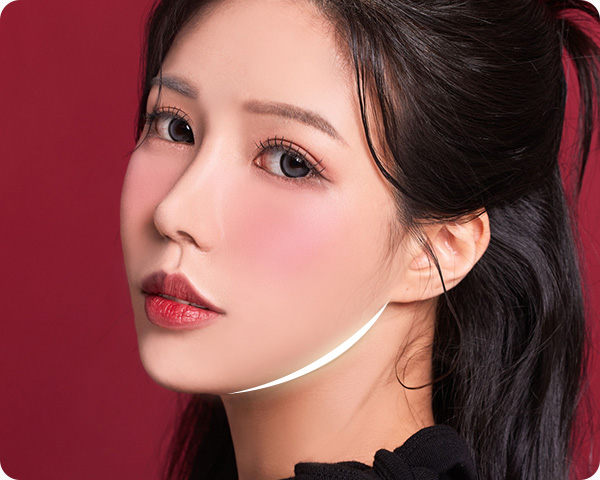 사각턱수술 하악각 브이라인 갸름한 얼굴라인