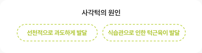 사각턱원인 선천적 과도한 발달 사각턱 식습관으로 인한 턱근육 발달