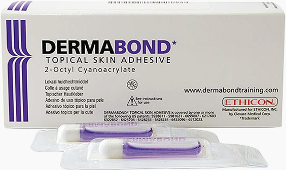 더마본드 흉터최소화 가슴축소술 실밥제거 없음