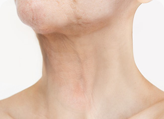 원더풀 목거상 세로주름