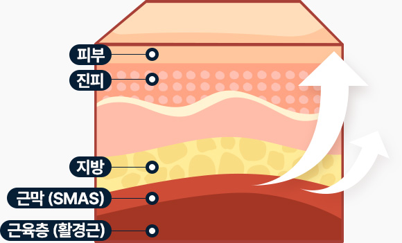 Full HD 내시경 이마거상 안전한 수술