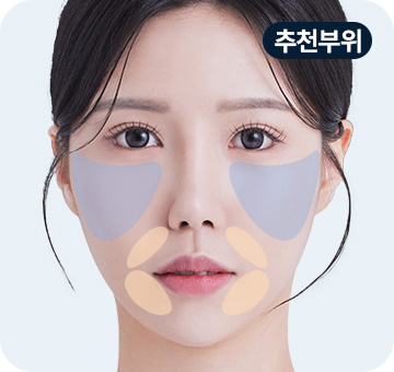 실리프팅 민트파인실 추천부위 윗광대 팔자주름 심부볼