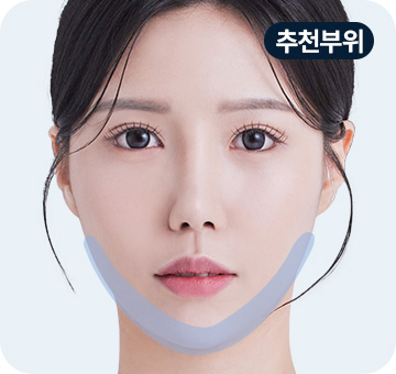 실리프팅 민트파인실 추천부위 이중턱