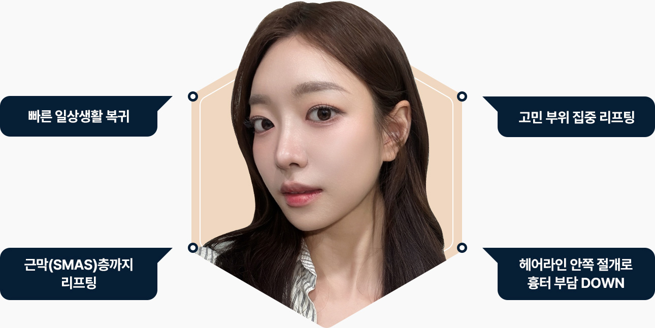 미니거상 순수자가지방 PRP 지방이식 높은 생착률 피부층에 균일한 이식 부작용 최소화 특수 미세 캐뉼라 조직손상 흉터 최소화