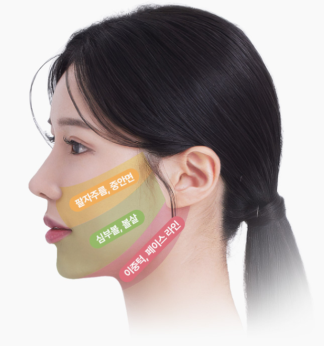원더풀성형외과 미니거상 고민부위 팔자주름 중안면 심부볼 볼살 이중턱 페이스라인