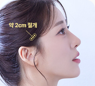 원더풀 성형외과 미니거상