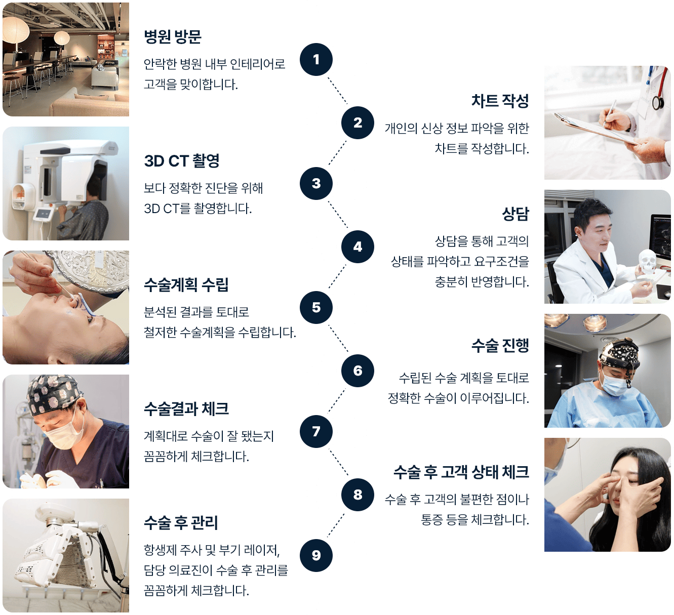 코성형 과정 병원방문 차트작성 3D CT 촬영 상담 수술계획수립 수술 진행 수술결과 체크 고객상태 체크 수술 후 관리