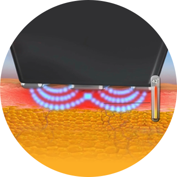 인모드 FORMA 모드