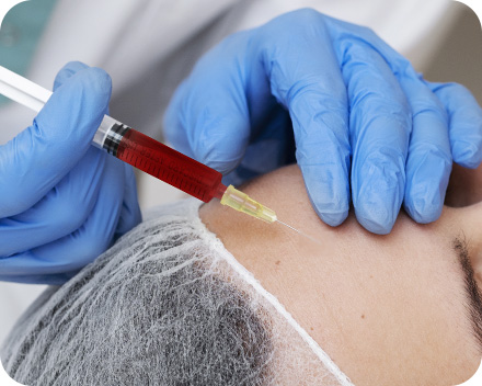 원더풀 줄기세포 피부주사 진피층에 주입