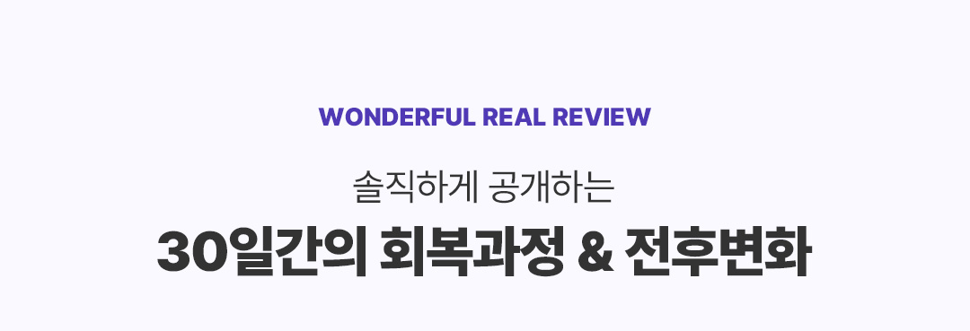 리얼후기 타이틀