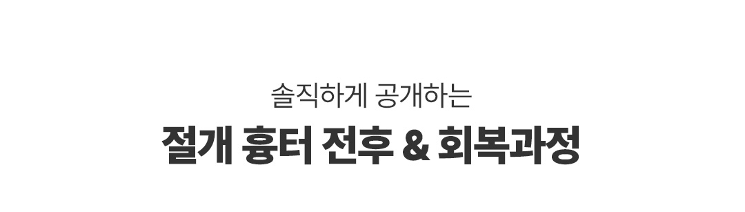 절개 흉터 타이틀