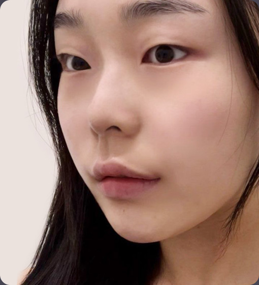 슬라이드 이미지