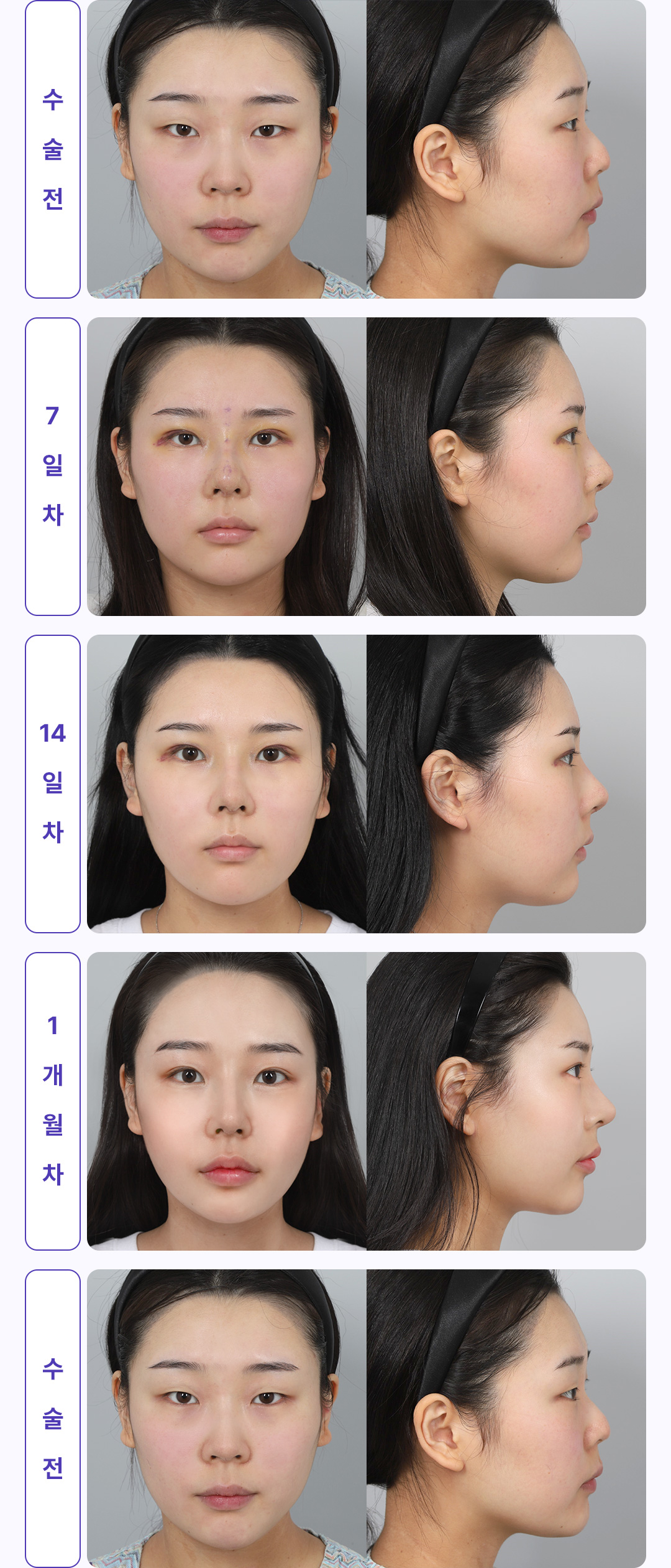 30일간 변화과정