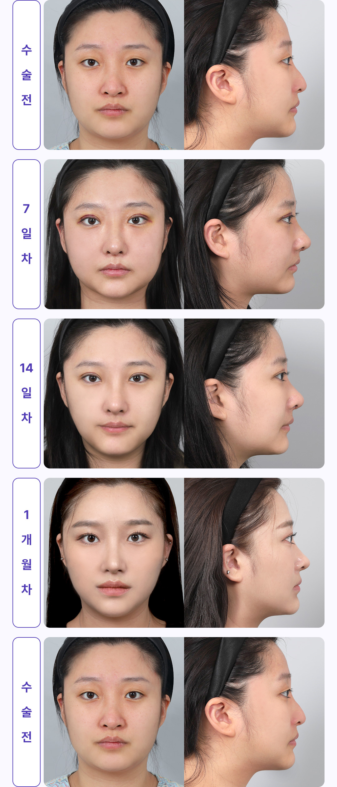 30일간 변화과정