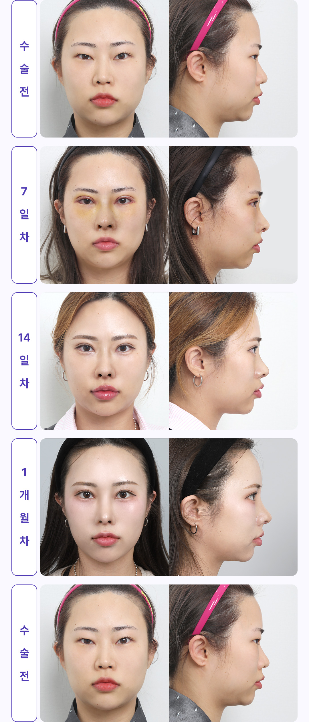 30일간 변화과정